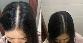 Unveil the secret recipe for treating hair loss! Taoist health preservation techniques