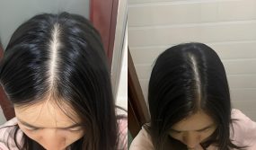 Unveil the secret recipe for treating hair loss! Taoist health preservation techniques