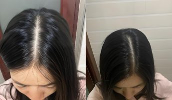 Unveil the secret recipe for treating hair loss! Taoist health preservation techniques