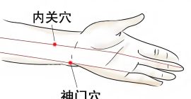 Read more about the article 内关穴、神门穴、三阴交穴每天按揉5分钟，安神定志，治疗失眠