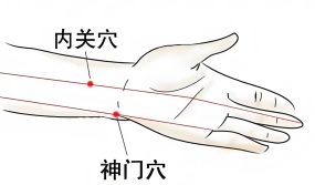 内关穴、神门穴、三阴交穴每天按揉5分钟，安神定志，治疗失眠